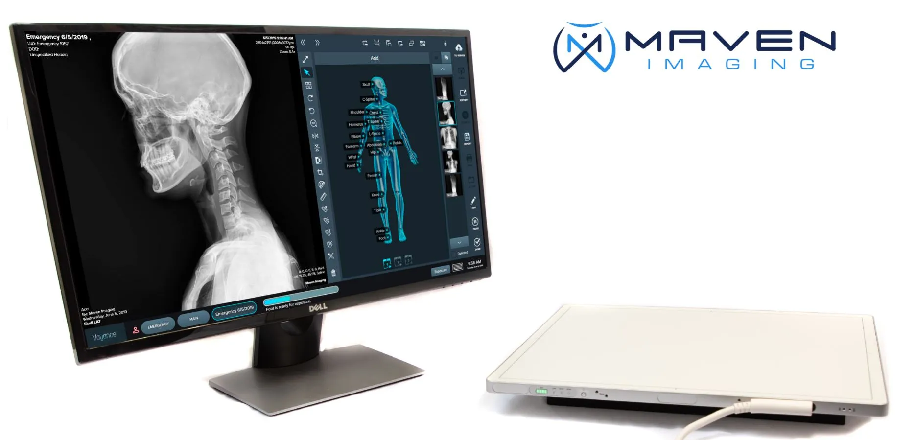 Del Medical Standard floor to  wall mounted FTW-FTC X-ray systems