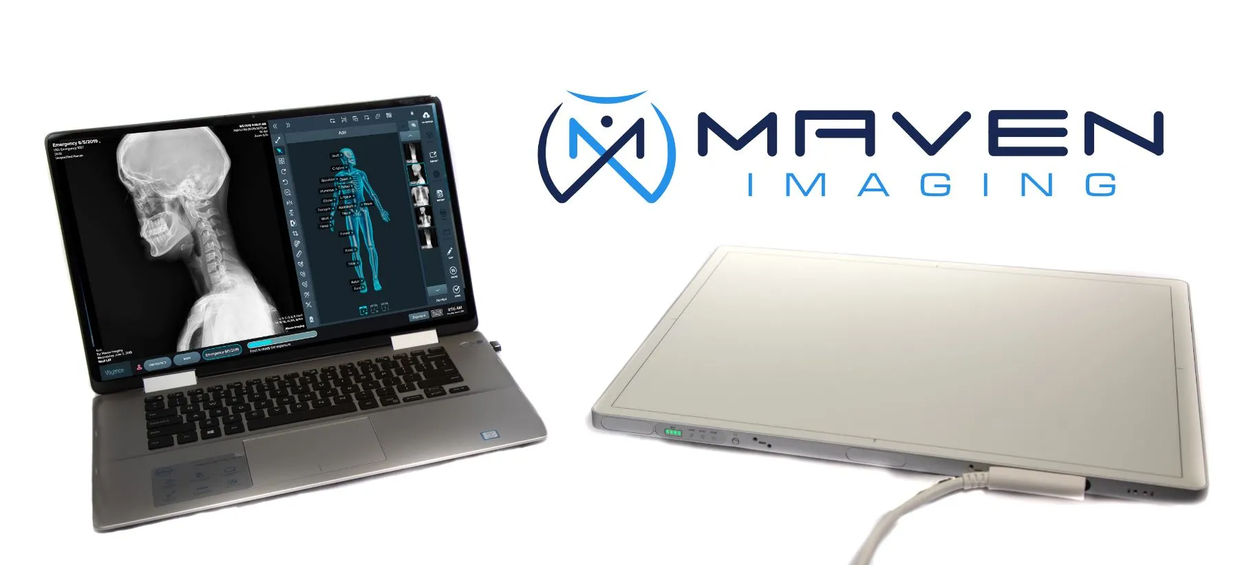 PatientImage Handheld X-ray w/14x17 Wireless Flat Panel DR System